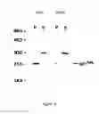 Fig. 04 - High Dose Dehydroepiandrosterone as Anticancer Treatment With Multi-faceted Reconstitution of Otherwise Depleted Metabolites