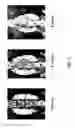 Fig. 07 - Slow release oxysterols and methods of use
