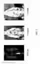 Fig. 08 - Slow release oxysterols and methods of use