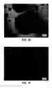 Fig. 04 - Dosage form comprising an active ingredient and a plurality of solid porous microcarriers