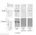 Fig. 11 - Lysosomal Targeting Peptides and Uses Thereof