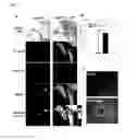 Fig. 08 - SONOSENSITIZER COMPOSITION CONTAINING TITANIUM OXIDE NANOPARTICLE AS ACTIVE INGREDIENT, COMPOSITION FOR PREVENTING OR TREATING CANCER COMPRISING THE SAME, AND THE PREPARATION THEREOF