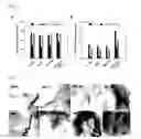 Fig. 12 - SONOSENSITIZER COMPOSITION CONTAINING TITANIUM OXIDE NANOPARTICLE AS ACTIVE INGREDIENT, COMPOSITION FOR PREVENTING OR TREATING CANCER COMPRISING THE SAME, AND THE PREPARATION THEREOF