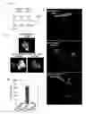 Fig. 14 - SONOSENSITIZER COMPOSITION CONTAINING TITANIUM OXIDE NANOPARTICLE AS ACTIVE INGREDIENT, COMPOSITION FOR PREVENTING OR TREATING CANCER COMPRISING THE SAME, AND THE PREPARATION THEREOF
