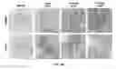 Fig. 09 - Fluorocoxib A loading into ROS-responsive nanoparticles