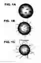 Fig. 02 - Imaging and treatment of pathophysiologic conditions by Cerenkov radiation