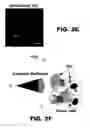 Fig. 07 - Imaging and treatment of pathophysiologic conditions by Cerenkov radiation