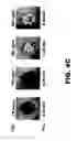 Fig. 12 - Imaging and treatment of pathophysiologic conditions by Cerenkov radiation