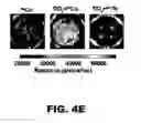 Fig. 14 - Imaging and treatment of pathophysiologic conditions by Cerenkov radiation