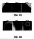 Fig. 16 - Imaging and treatment of pathophysiologic conditions by Cerenkov radiation