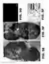 Fig. 17 - Imaging and treatment of pathophysiologic conditions by Cerenkov radiation