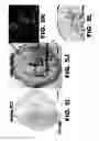 Fig. 18 - Imaging and treatment of pathophysiologic conditions by Cerenkov radiation