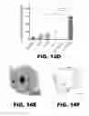 Fig. 28 - Imaging and treatment of pathophysiologic conditions by Cerenkov radiation