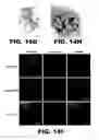 Fig. 29 - Imaging and treatment of pathophysiologic conditions by Cerenkov radiation