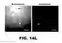 Fig. 31 - Imaging and treatment of pathophysiologic conditions by Cerenkov radiation