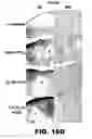 Fig. 37 - Imaging and treatment of pathophysiologic conditions by Cerenkov radiation