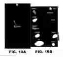 Fig. 42 - Imaging and treatment of pathophysiologic conditions by Cerenkov radiation