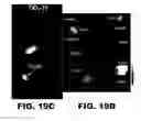 Fig. 43 - Imaging and treatment of pathophysiologic conditions by Cerenkov radiation