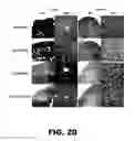 Fig. 44 - Imaging and treatment of pathophysiologic conditions by Cerenkov radiation