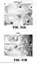 Fig. 59 - Imaging and treatment of pathophysiologic conditions by Cerenkov radiation