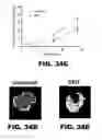 Fig. 64 - Imaging and treatment of pathophysiologic conditions by Cerenkov radiation
