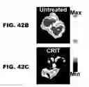 Fig. 77 - Imaging and treatment of pathophysiologic conditions by Cerenkov radiation