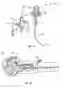 Fig. 02 - Method and system for steam sterilization of endoscopes