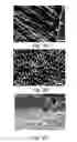 Fig. 06 - Amelogenin-chitosan hydrogel for dentin hypersensitivity