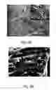 Fig. 08 - Amelogenin-chitosan hydrogel for dentin hypersensitivity