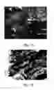 Fig. 09 - Amelogenin-chitosan hydrogel for dentin hypersensitivity