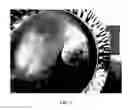 Fig. 06 - Implants having a high drug load of an oxysterol and methods of use