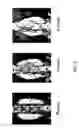 Fig. 07 - Implants having a high drug load of an oxysterol and methods of use