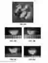 Fig. 04 - Electrospinning of cartilage and meniscus matrix polymers