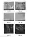 Fig. 06 - Electrospinning of cartilage and meniscus matrix polymers