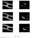 Fig. 05 - Coatings with crystallized active agent(s) and methods