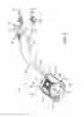Fig. 04 - In-joint sensor for a surgical fluid management pump system