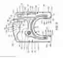 Fig. 07 - In-joint sensor for a surgical fluid management pump system