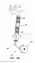 Fig. 06 - ENDOVASCULAR COMPLIANCE ASSEMBLY