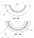 Fig. 07 - ENDOVASCULAR COMPLIANCE ASSEMBLY