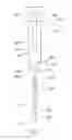 Fig. 02 - CANNULA, AN INJECTION OR INFUSION DEVICE AND METHODS OF USING THE CANNULA OR THE INJECTION OR INFUSION DEVICE