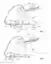 Fig. 02 - Systems and methods for treating an airway using a tapered adapter device