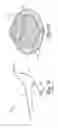 Fig. 02 - Dilator and method for penile prosthetic implantation