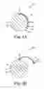 Fig. 04 - Dilator and method for penile prosthetic implantation