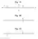 Fig. 02 - Apparatus and methods for assisted breathing by transvascular nerve stimulation