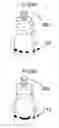 Fig. 11 - Method and means to improve the effects of electrical cell and neuron stimulation with random stimulation in both location and time