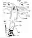 Fig. 13 - Method and means to improve the effects of electrical cell and neuron stimulation with random stimulation in both location and time