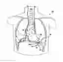 Fig. 01 - Hemodynamic performance enhancement through asymptomatic diaphragm stimulation