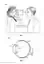 Fig. 02 - Methods and systems for diagnosing and treating eyes using laser therapy