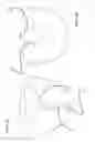 Fig. 32 - Head and neck protection apparatus and methods
