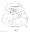 Fig. 08 - Chill plate for equiax casting solidification control for solid mold casting of reticulated metal foams